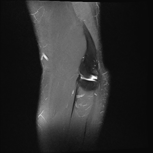 Click on the Serie image to view the images of Wieszt, Gnter